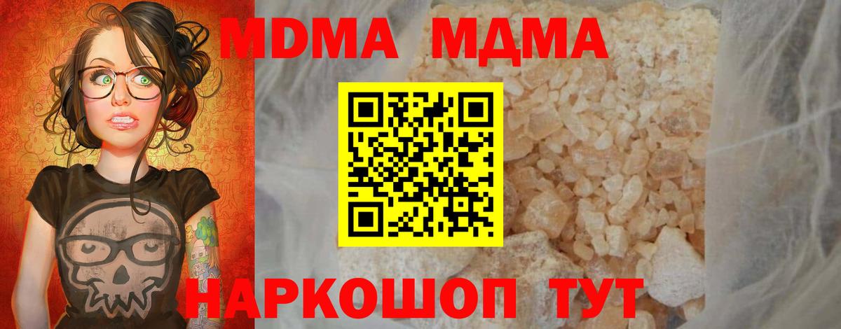 Бошки Шишки Воркута